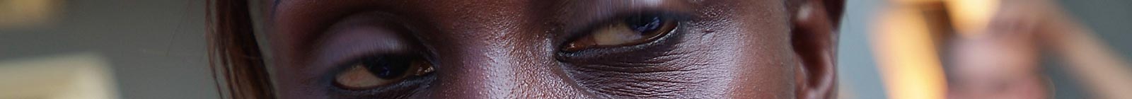 Eyes of Fantakounda, Conakry, Guinea.